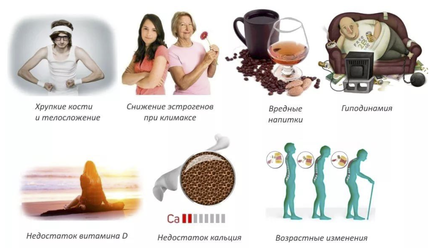 Причины остеопороза